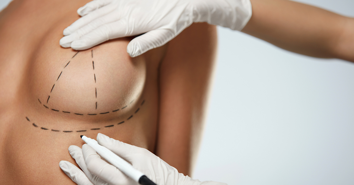 What's trending in breast augmentation?